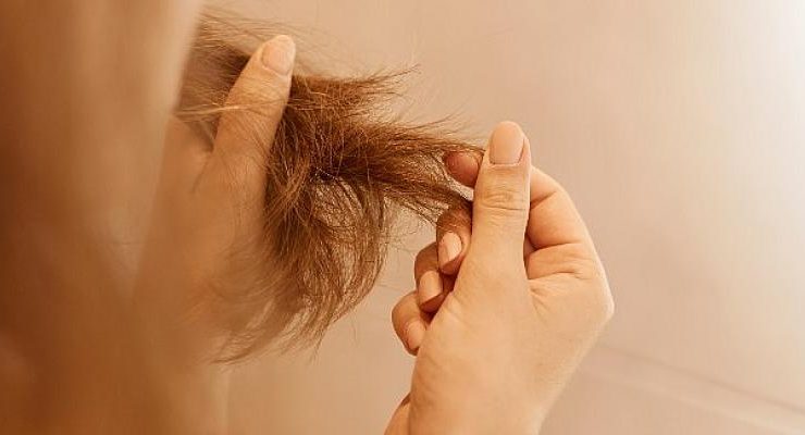 Tiroid Hastalığında Kaybedilen Saçlar Safir Fue Tekniğiyle Geri Kazandırılıyor